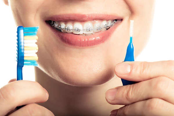 Are Gapped Teeth A Concern?