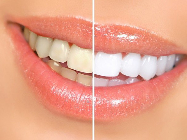 Dental Excellence of Greenhaven