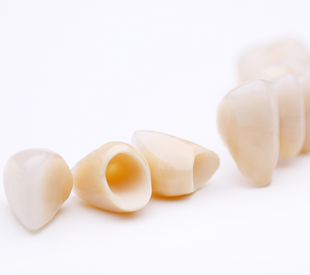 Sacramento Dental Crowns and Dental Bridges