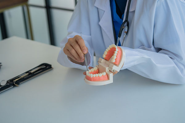 Dental Inlay, Onlay, Fillings, Or Crowns: Which Is Best For You?