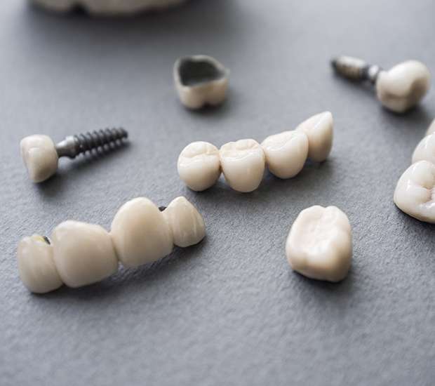 Sacramento The Difference Between Dental Implants and Mini Dental Implants