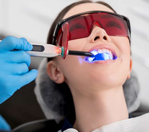 Sacramento Professional Teeth Whitening