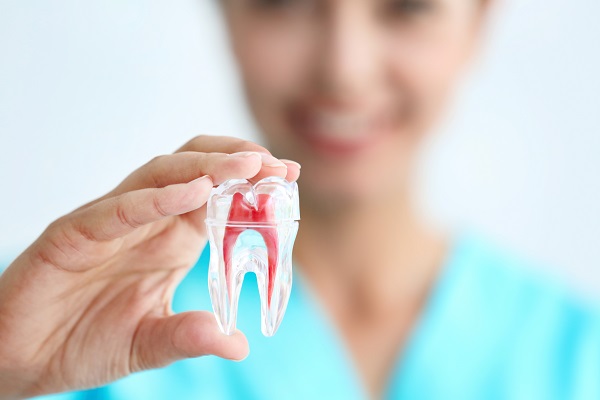 Will I Get A Dental Crown After A Root Canal?