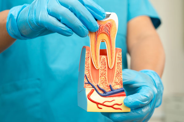 Debunking Root Canal Myths: How This Procedure Protects Oral Health