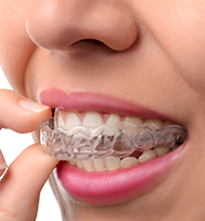 Clear Aligners - Almost Invisible Braces Sacramento, CA