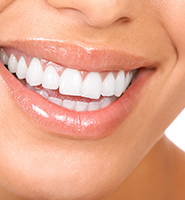 Teeth Whitening Services Sacramento, CA